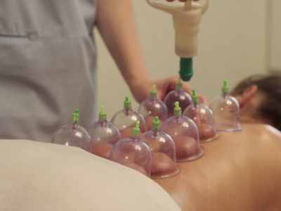 Cupping Therapy